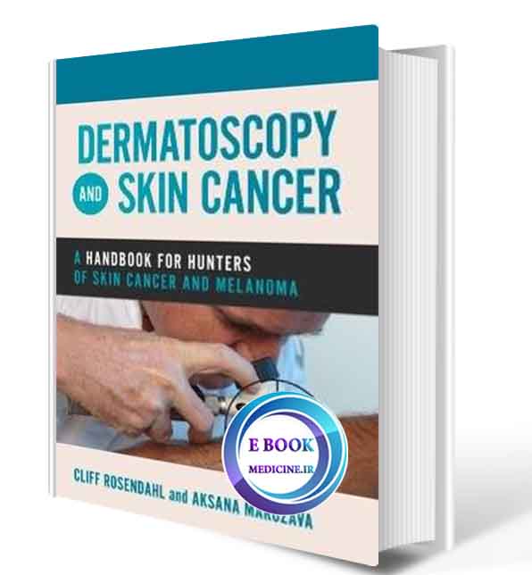 دانلود کتاب Dermatoscopy and Skin Cancer: A handbook for hunters of skin cancer and melanoma 2019 (Original PDF) 